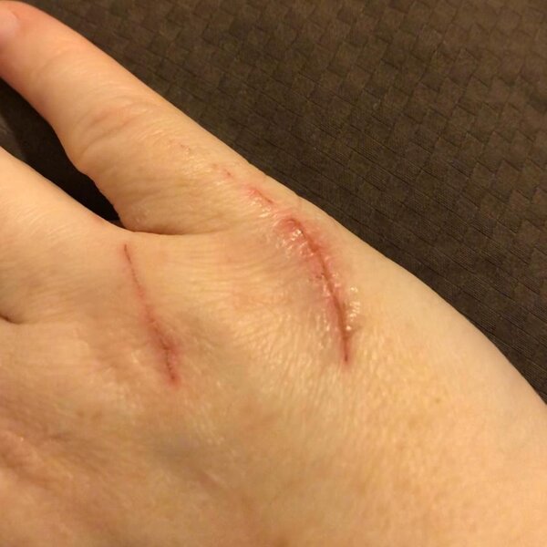 Help! My Cat Keeps Biting What Can I Do About It? The Goody Pet